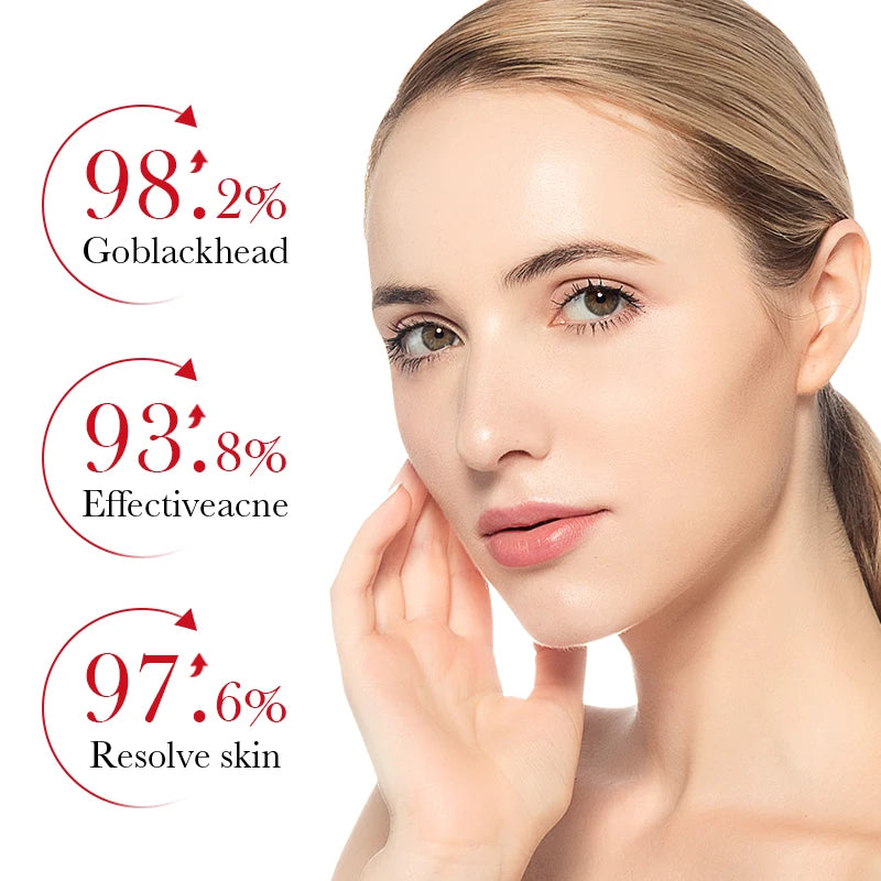 1/2PCS BIOAOUA Acid Acne Removing Cream Making The Skin Even And Smooth Dredging And Clearing Pores Removing Dead Skin