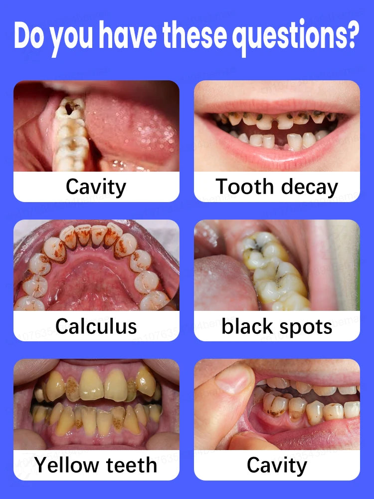 The best-selling product cleans your mouth, prevents tooth decay, and helps you regain your confidence