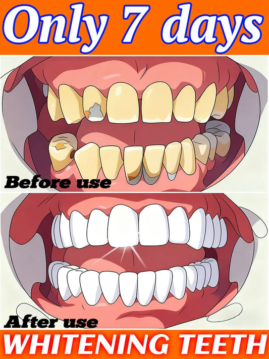 The best-selling product cleans your mouth, prevents tooth decay, and helps you regain your confidence